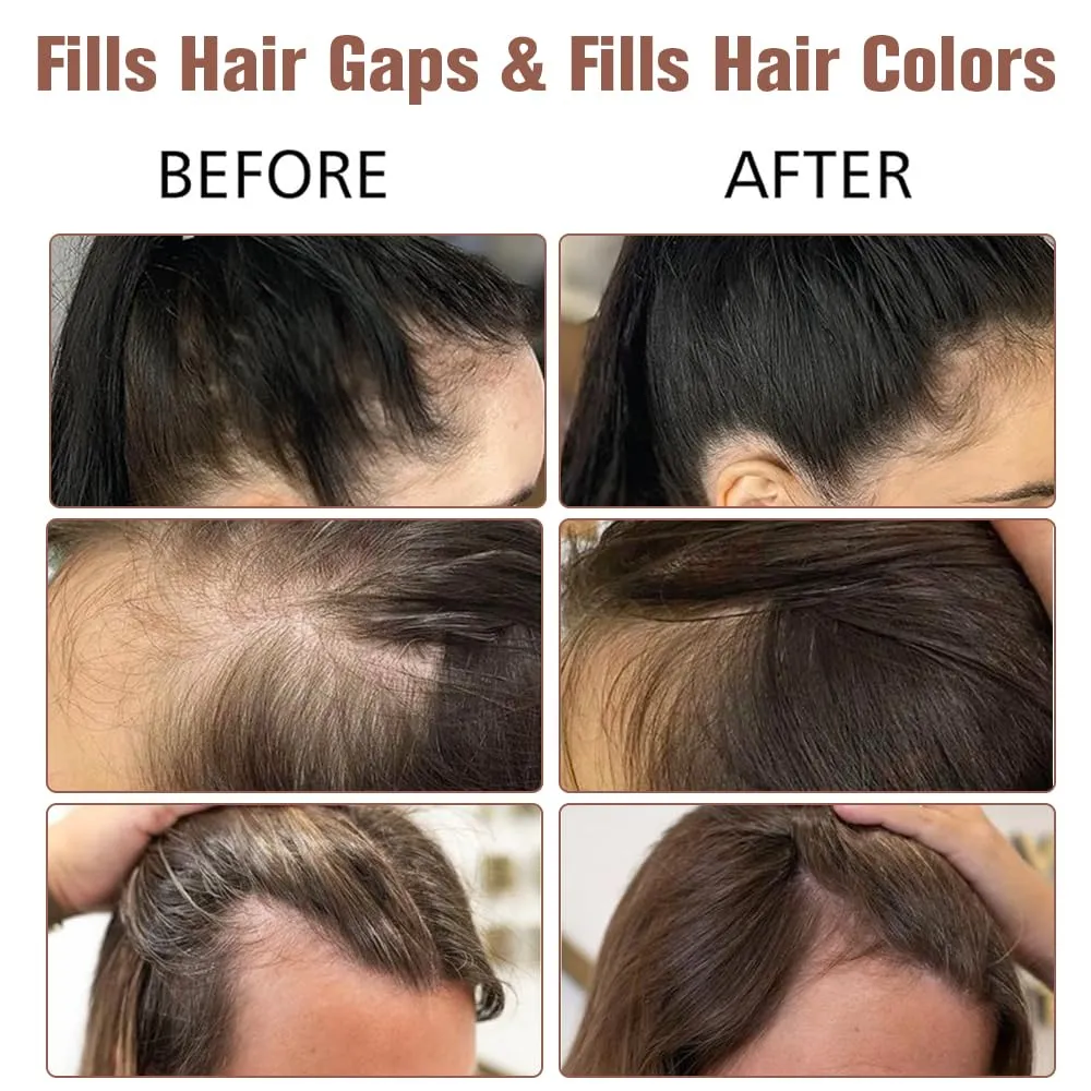 2Pcs Hairline Powder with Brush Hair Shadow Root Touch Up Powder Set for Thinning Hair Gray Hair Coverage Hairline Concealer for Women (#11-Light Brown)