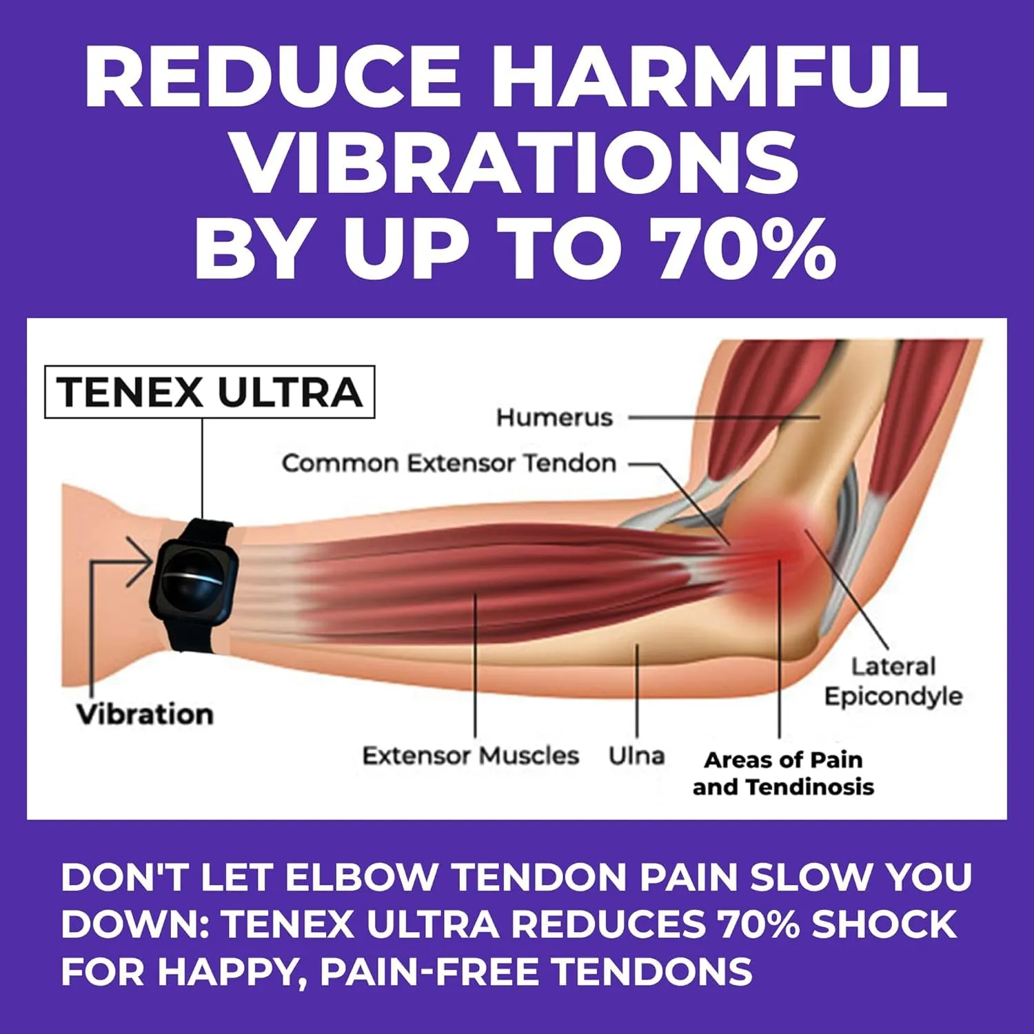 TENEX Ultra Tennis Elbow Brace, Wrist-worn Non-Compression Band, Supports Relief & Recovery from Tennis, Pickleball, Golf, Repetitive Motion Tendonitis, Absorbs Shocks That Cause Pain in Men & Women